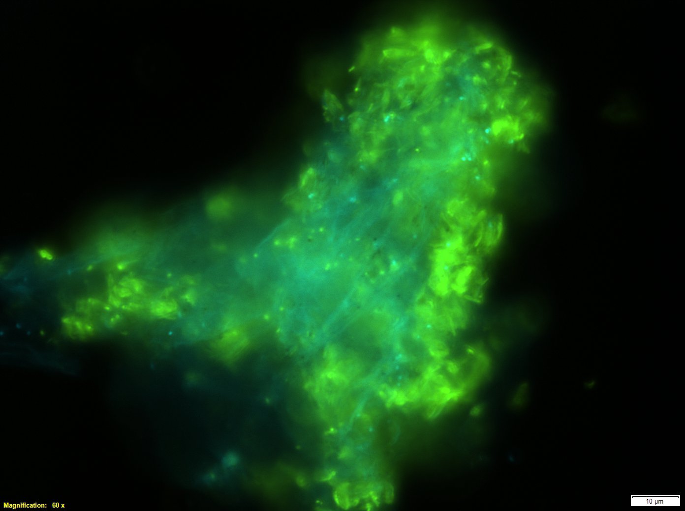 biomethane producing microbial community in the microscope